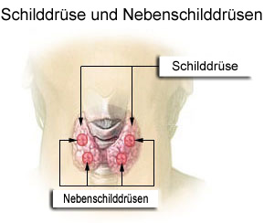 Est-ce qu'un problème de thyroïde est le même partout dans le monde ?